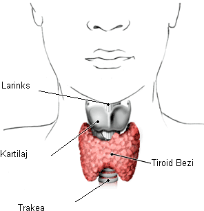 tiroit